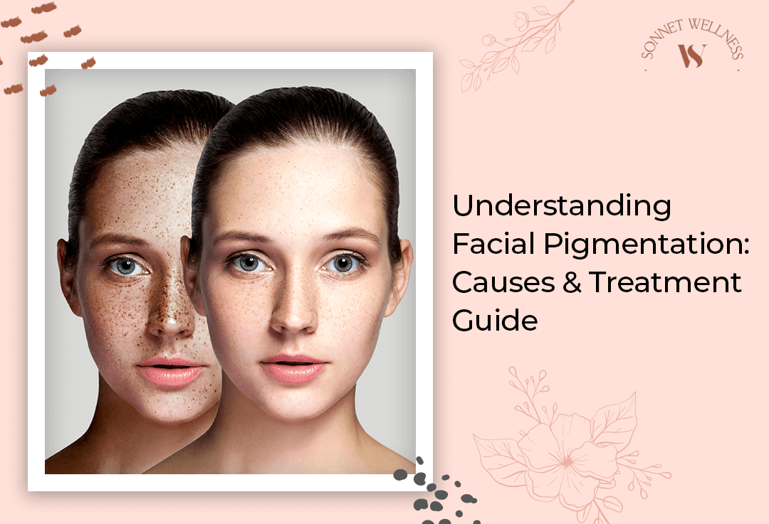 Understanding Facial Pigmentation : Causes & Treatment Guide